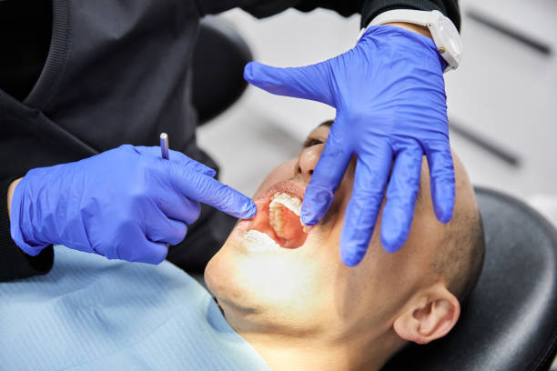 Best Chipped Tooth Repair Near Me  in Marietta Alderwood, WA